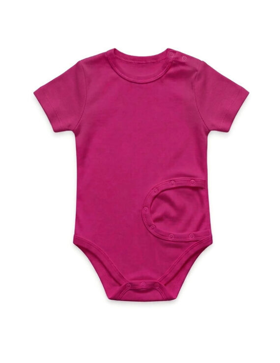 Kurzärmliger pinker PEG Body aus Baumwolle für Mädchen mit Sonde.